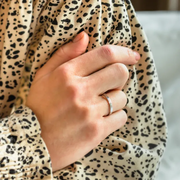 Original wedding ring with tree bark surface NIXON Image